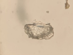 Marssonina betulae