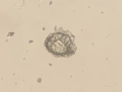 Marssonina betulae
