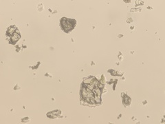 Marssonina betulae
