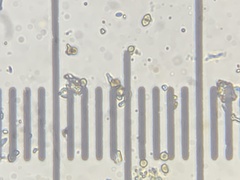 Ruptoseptoria unedonis