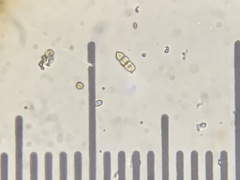 Ruptoseptoria unedonis