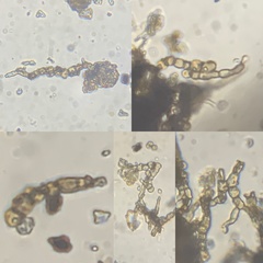 Ruptoseptoria unedonis