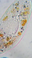Paramecium