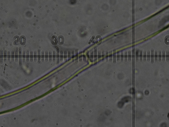 Thelephora anthocephala