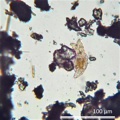 Philodina acuticornis odiosa