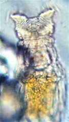 Philodina acuticornis odiosa