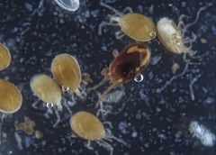 Neocnemidocoptes gallinae