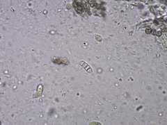 Dacrymyces minor