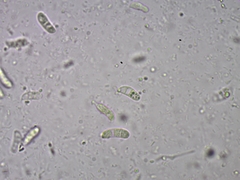 Dacrymyces minor