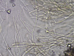 Dacrymyces minor
