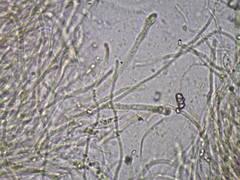Dacrymyces minor