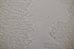 Pyrenopeziza digitalina