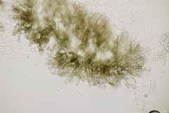 Pyrenopeziza digitalina