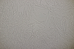 Pyrenopeziza digitalina