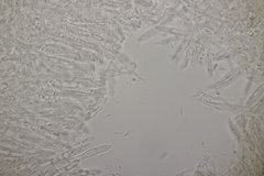 Pyrenopeziza digitalina