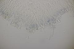 Pyrenopeziza digitalina