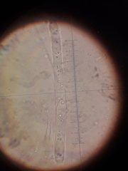 Sclerotinia trifoliorum