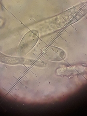 Sclerotinia trifoliorum