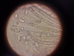 Sclerotinia trifoliorum