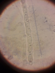 Sclerotinia trifoliorum