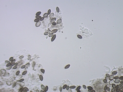 Chaenothecopsis