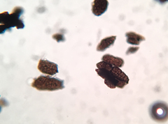 Berkleasmium conglobatum
