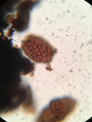 Berkleasmium conglobatum