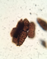 Berkleasmium conglobatum