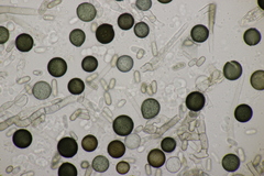 Thielaviopsis paradoxa