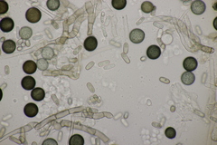 Thielaviopsis paradoxa