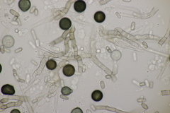 Thielaviopsis paradoxa