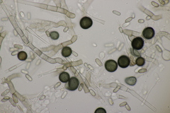 Thielaviopsis paradoxa