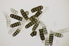 Thielaviopsis basicola