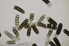 Thielaviopsis basicola