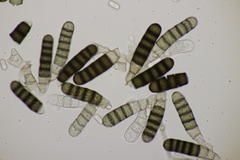 Thielaviopsis basicola