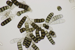 Thielaviopsis basicola