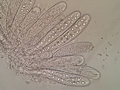 Bryostroma trichostomi