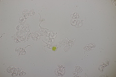 Illosporiopsis christiansenii