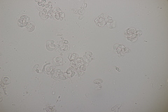 Illosporiopsis christiansenii