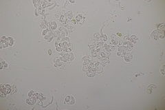 Illosporiopsis christiansenii