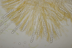 Octospora gyalectoides