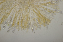 Octospora gyalectoides