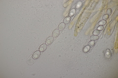 Octospora gyalectoides