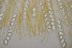 Octospora gyalectoides