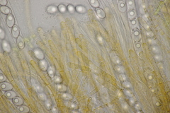 Octospora gyalectoides