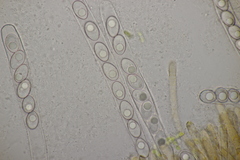 Octospora gyalectoides