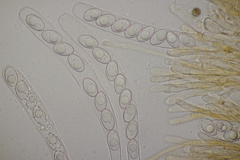 Octospora gyalectoides
