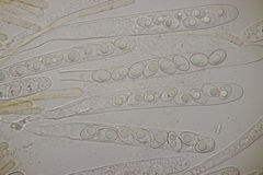 Octospora gyalectoides