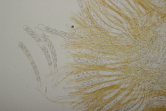 Octospora gyalectoides