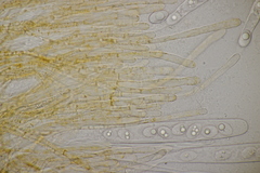 Octospora gyalectoides